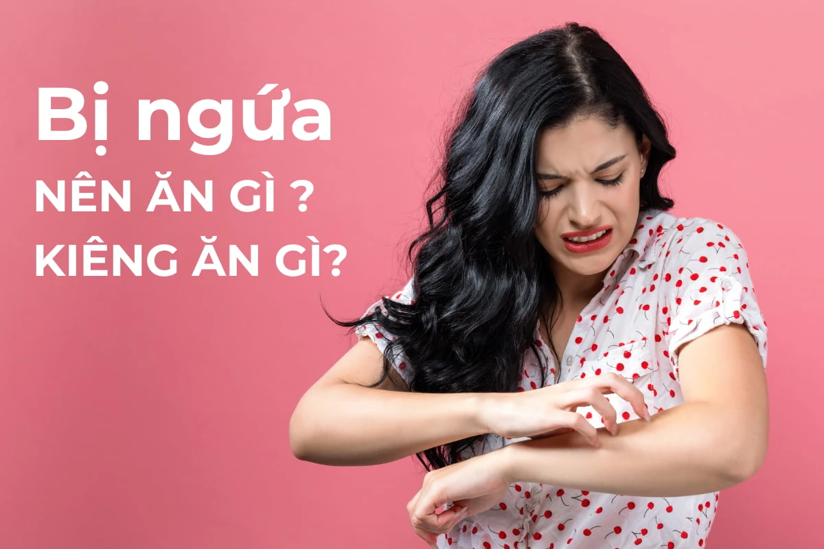Mẩn ngứa NÊN ĂN gì và KIÊNG ĂN gì để cải thiện?
